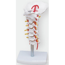 Le modèle de simulation de la bande carotidienne cervicale